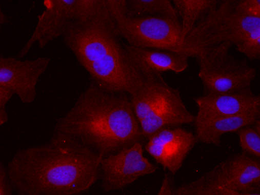 <p>Hepatocitos tumorales tratados con melatonina. Foto: Ibiomed/DiCYT</p>