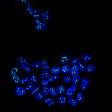 <p>Núcleos de células metastáticas de cáncer de mama con la proteína MSK1 en verde. / Cristina Figueras-Puig, IRB Barcelona</p>