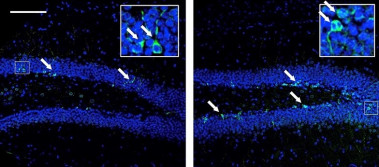 <p>Imagen de microscopía confocal del giro dentado (hipocampo). El marcaje verde señala la diferenciación neuronal, que es más elevada en la muestra de animales tratados con cannabidiol (la imagen de la derecha). / UPF</p>