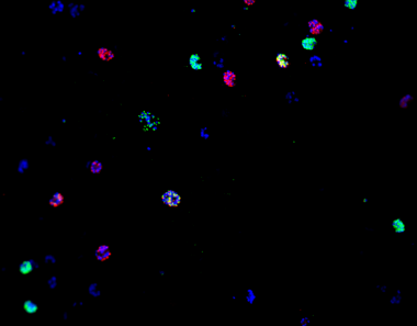 <p>Expresión de la proteína CLAG3 en <em>P. falciparum</em>, detectada por inmunofluorescencia. / Miró et al, 2019</p>