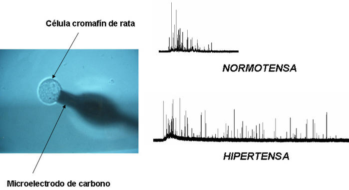 <p> Detección de la liberación de adrenalina en una sola célula con un microelectrodo de carbono</p>