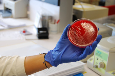 <p>Una de las cepas de listeria que el CNM ha recibido para su análisis. / María Marín </p>