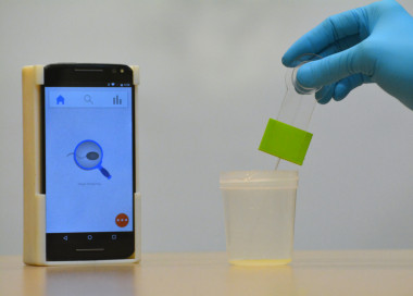 <p>El analizador de semen para teléfonos inteligentes prueba la infertilidad masculina en menos de cinco segundos con una configuración impresa en 3D que cuesta unos 4 euros. / Vignesh Natarajan</p>