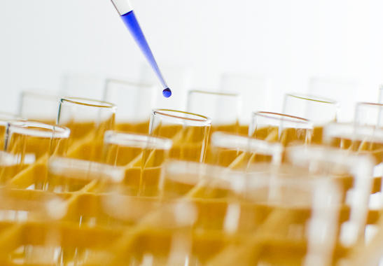 <p>El primer objetivo de los ensayos clínicos es evaluar la seguridad del medicamento. / <a href="http://www.sxc.hu/browse.phtml?f=download&id=1258732" target="_blank">123dan321</a>. </p>