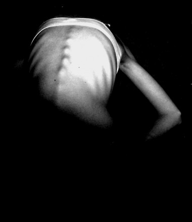<p>La caquexia provoca anorexia, anemia y astenia en una persona enferma. Foto: St4rbucks.</p>