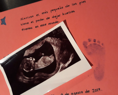 <p>La periodista y bloguera Carmen Osorio perdió a su bebé a las 28 semanas de gestación. En su blog <a href="https://nosoyunadramamama.com/2017/08/24/muerte-fetal-infeccion-placenta-corioamnionitis/" target="_blank">No soy una mamá drama</a> explicó el duro proceso.</p>