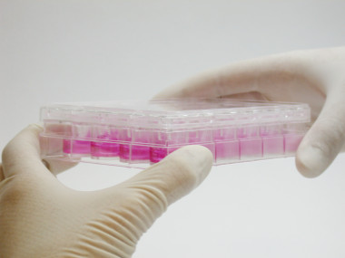<p>Las áreas más intensivas en creación de spin off son la informática, la I+D, la química y la biotecnología. / Advancell</p>