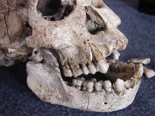 <p><a href="http://plataformasinc.es/index.php/esl/Multimedia/Imagenes/Galeria-de-actualidad-del-23-al-27-de-marzo-2009/Los-dientes-que-hablan-y-IV" target="_self">Craneo y mandibula de un homínido de Dmanisi</a>. Foto: María Martinón-Torres.</p>