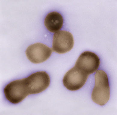 <p><a href="http://plataformasinc.es/index.php/esl/imagenes/inicio/(imagen)/55351" target="_self">Células de <em>Mycoplasma mycoides JCVI-syn1.0</em></a>, con genoma sintético. Imagen: JVC Institute.</p>