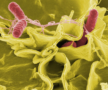 
<!-- START: including template: extension/sinc/design/ezwebin/templates/content/datatype/view/ezxmltags/paragraph.tpl (design:content/datatype/view/ezxmltags/paragraph.tpl) -->
<p>La bacteria 
<!-- START: including template: extension/sinc/design/sinc/templates/content/datatype/view/ezxmltags/emphasize.tpl (design:content/datatype/view/ezxmltags/emphasize.tpl) -->
<em>Salmonella typhimurium</em>
<!-- STOP: including template: extension/sinc/design/sinc/templates/content/datatype/view/ezxmltags/emphasize.tpl (design:content/datatype/view/ezxmltags/emphasize.tpl) -->
 (en rojo) invadiendo células humanas en cultivo. Foto: NIAID.</p>
<!-- STOP: including template: extension/sinc/design/ezwebin/templates/content/datatype/view/ezxmltags/paragraph.tpl (design:content/datatype/view/ezxmltags/paragraph.tpl) -->
